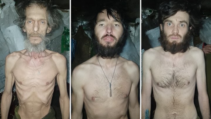 Fotografie vojáků na frontě trpících těžkou podvýživou